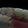 ceramo-implant-2.jpg