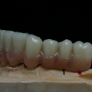 ceramo-implant2.jpg