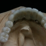 ceramo-implant3.jpg
