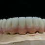 ceramo-implant6.jpg