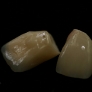 fixe_implant-02.jpg