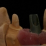 fixe_implant-03.jpg