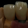 fixe_implant-04.jpg